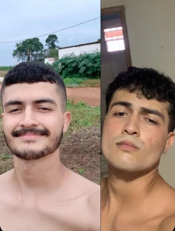 Antes e depois do rosto: definição facial e maxilar mais marcado